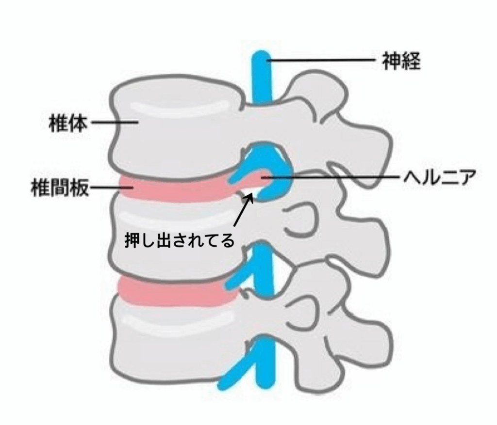 画像に alt 属性が指定されていません。ファイル名: image-5-1024x877.png